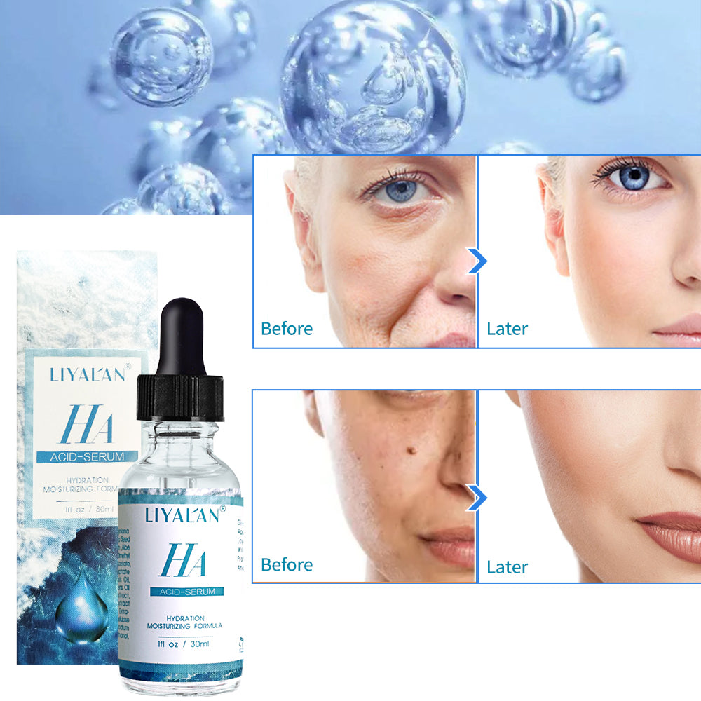 Hyaluronic acid serum