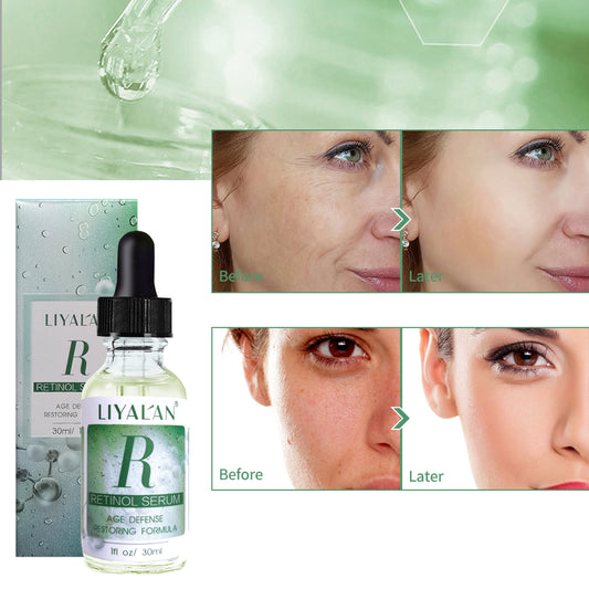 Retinol Serum 2.5% with Hyaluronic Acid Face Serum Vegan Anti Aging Wrinkles